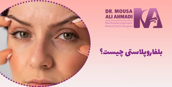 بلفاروپلاستی چیست؟