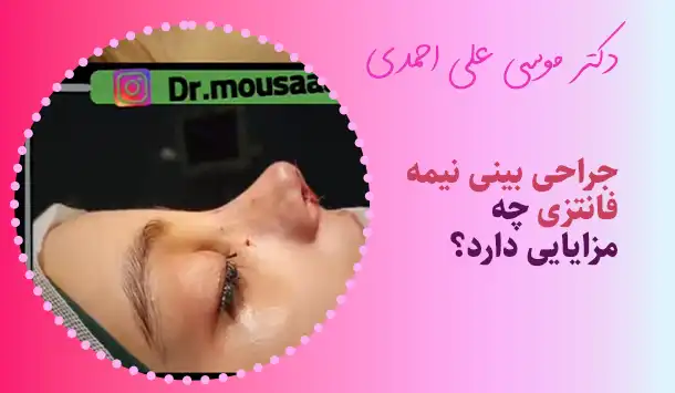 جراحی بینی نیمه فانتزی چه مزایایی دارد؟ 