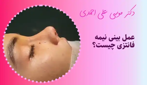 عمل بینی نیمه فانتزی چیست؟
