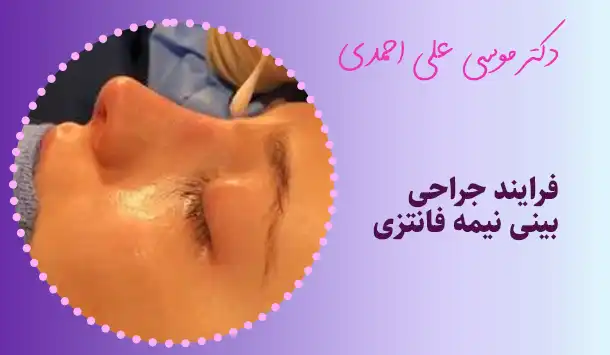 فرایند جراحی بینی نیمه فانتزی