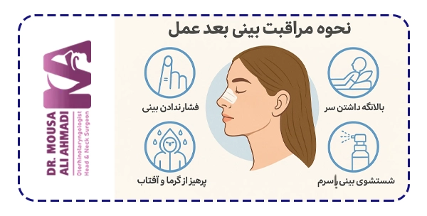 نحوه مراقبت از بینی بعد از عمل