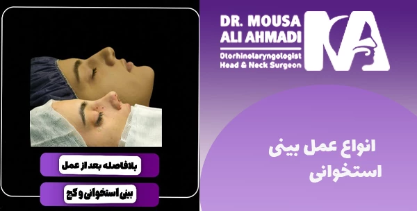   انواع عمل بینی استخوانی