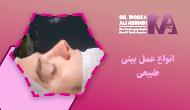 انواع عمل بینی طبیعی