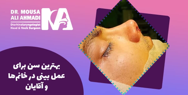 بهترین سن برای عمل بینی در خانم‌ها و آقایان