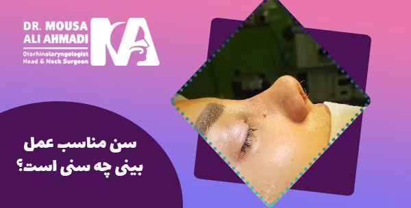 سن مناسب عمل بینی چه سنی است؟