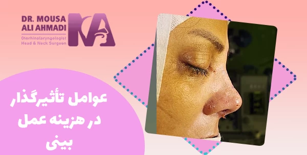 عوامل تأثیرگذار در هزینه عمل بینی