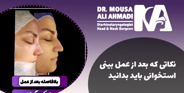 نکاتی که بعد از عمل بینی استخوانی باید بدانید