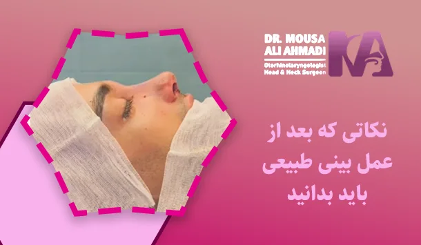 نکاتی که بعد از عمل بینی طبیعی باید بدانید