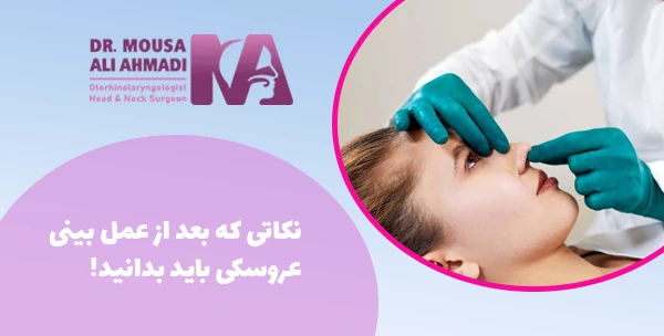 نکاتی که بعد از عمل بینی عروسکی باید بدانید!