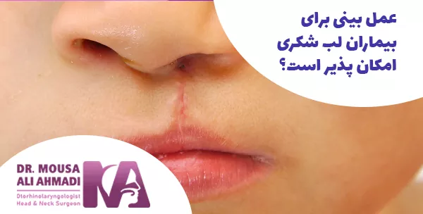 عمل بینی برای بیماران لب شکری امکان پذیر است؟