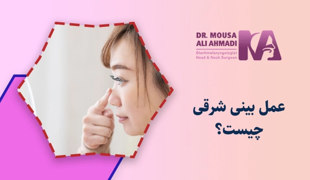 عمل بینی شرقی چیست؟