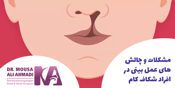 مشکلات و چالش های عمل بینی در افراد شکاف کام