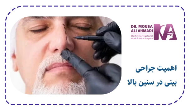 اهمیت جراحی بینی در سنین بالا