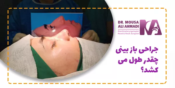 جراحی باز بینی چقدر طول می کشد؟