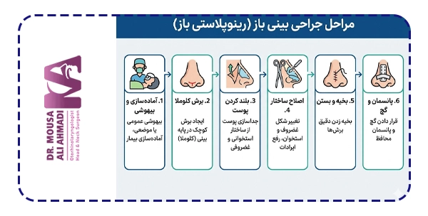 مراحل جراحی بینی باز