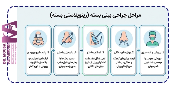 مراحل جراحی بینی بسته