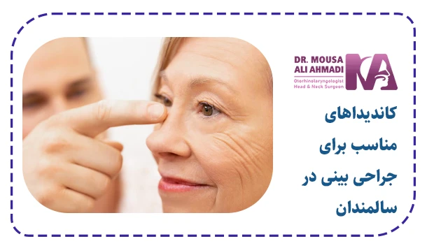 کاندیداهای مناسب برای جراحی بینی در سالمندان