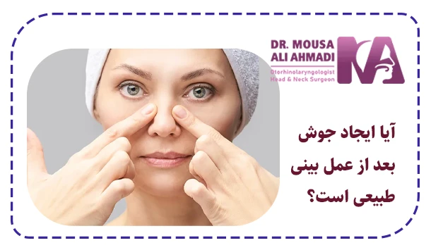 آیا ایجاد جوش بعد از عمل بینی طبیعی است؟