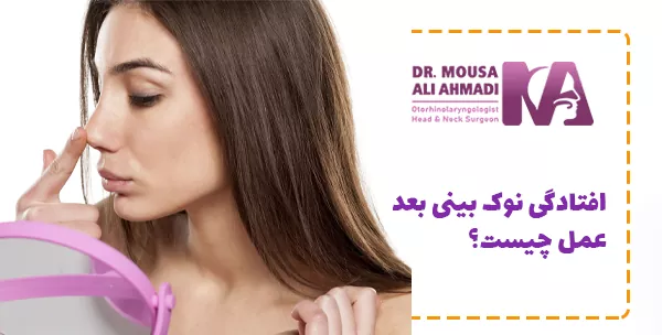 افتادگی نوک بینی بعد عمل چیست؟