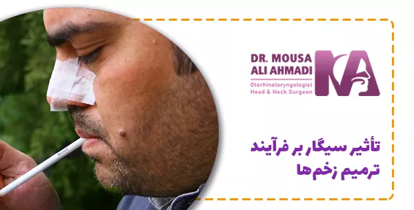 تأثیر سیگار بر فرآیند ترمیم زخم‌ها