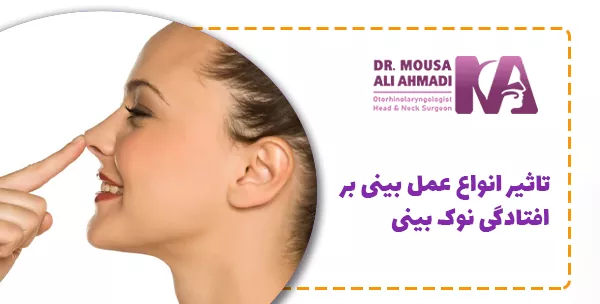 تاثیر انواع عمل بینی بر افتادگی نوک بینی