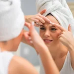 جوش بعد از عمل بینی