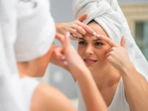 جوش بعد از عمل بینی