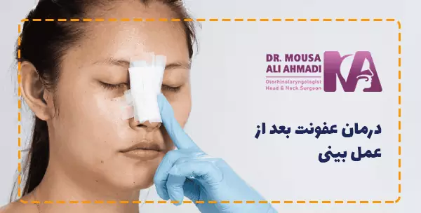 درمان عفونت بعد از عمل بینی
