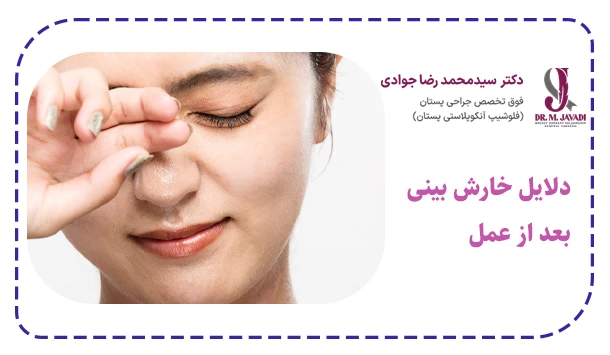 دلایل خارش بینی بعد از عمل