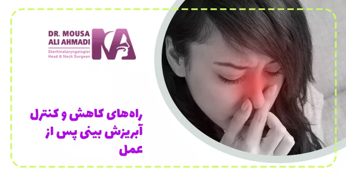 راه‌های کاهش و کنترل آبریزش بینی پس از عمل