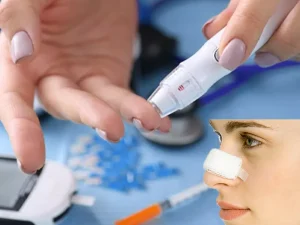 عمل بینی برای افراد دیابتی