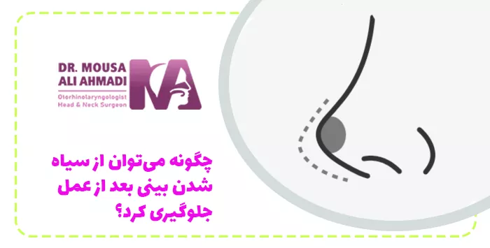 چگونه می‌توان از سیاه شدن بینی بعد از عمل جلوگیری کرد؟
