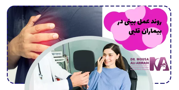 روند عمل بینی در بیماران قلبی