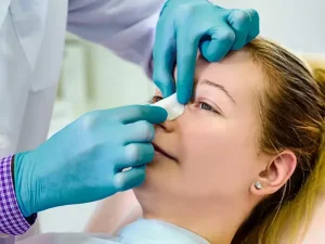 چسب زدن بینی بعد از عمل