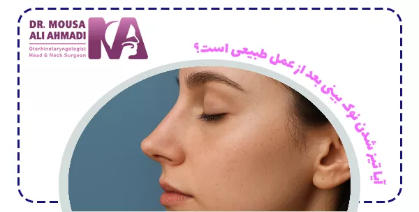 آیا تیز شدن نوک بینی بعد از عمل طبیعی است؟