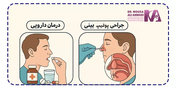درمان پولیپ بینی چگونه است؟