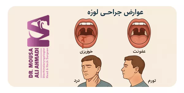 اهمیت دانستن خطرات جراحی لوزه