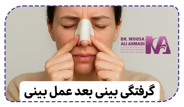 گرفتگی بینی بعد از جراحی تا چه زمانی طبیعی است